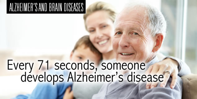 Alzheimer’s Disease alzheimers